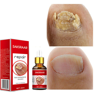 SAKSRAAR NAIL TREATMENT SERUM Repair Serum 20ml