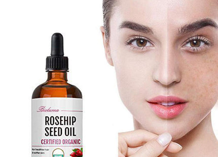 Hydrating Moisturizing Rosehip Facial Oil Massage Skin Care