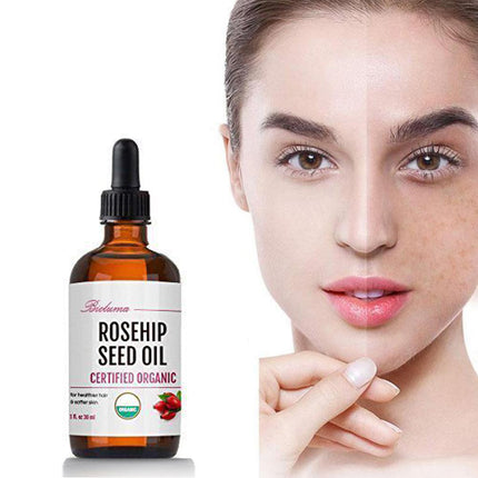 Hydrating Moisturizing Rosehip Facial Oil Massage Skin Care