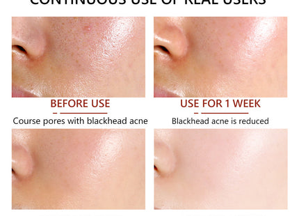 30Ml Cleansing Pore Salicylic Acid