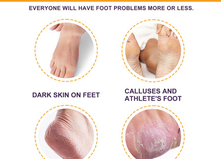 Nursing Care Of Milk Foot Wax Peeling