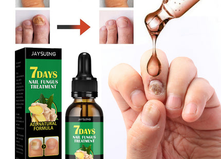 Ginger Nail Care Lotion Repair Hand And Foot Moisturizing