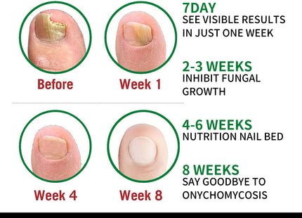 Ginger Nail Care Lotion Repair Hand And Foot Moisturizing