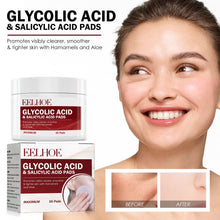Facial Glycolic Acid Gasket Moisturizing