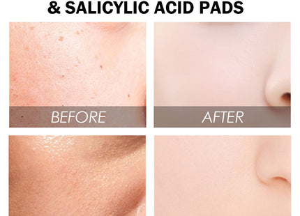 Facial Glycolic Acid Gasket Moisturizing