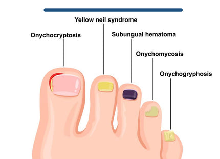 Hand And Foot Nail Care Solution