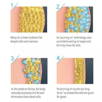 7 Days Leg Muscle Thin Fat Burning Oil Weight Loss Reshape