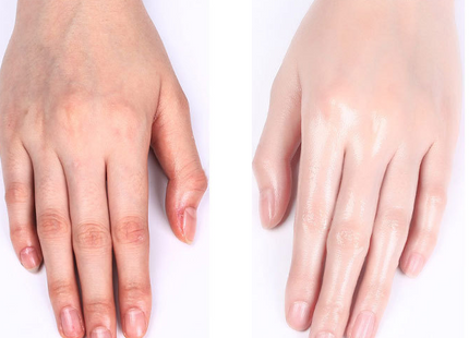 Moisturizing And Hydrating Hand Care Skin Care