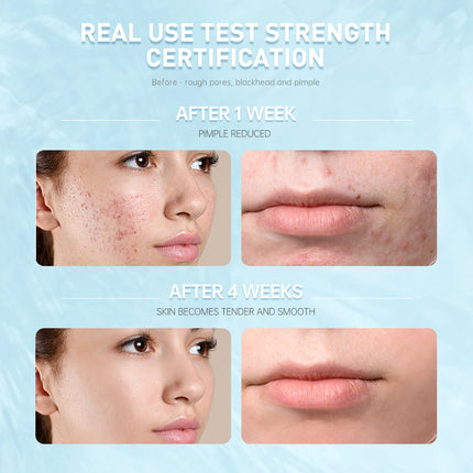 Salicylic Acid Repair Lotion Moisturizing And Repairing Sensitive Skin