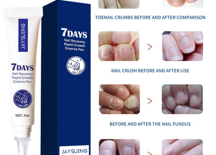 Hand And Foot Nail Care Solution
