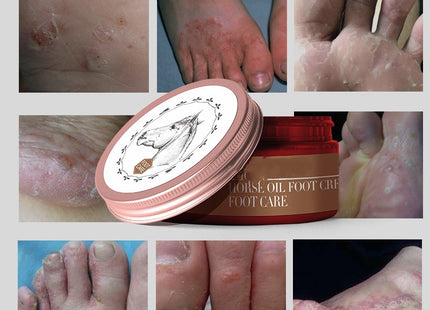 Moisturizing Horse Oil Foot Care Cream