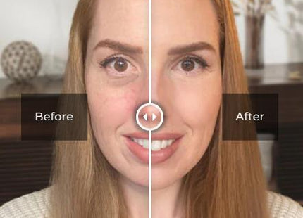 Eye Care Products