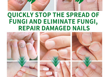 Ginger Nail Care Lotion Repair Hand And Foot Moisturizing