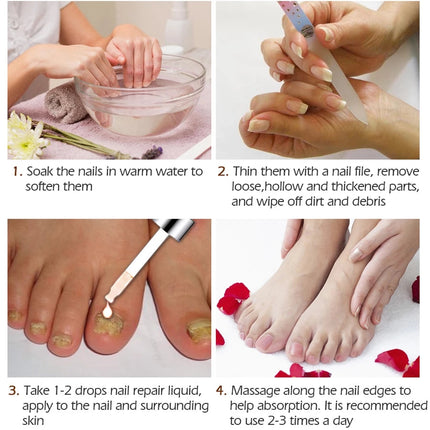 SAKSRAAR NAIL TREATMENT SERUM Repair Serum 20ml