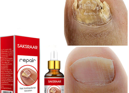 SAKSRAAR NAIL TREATMENT SERUM Repair Serum 20ml