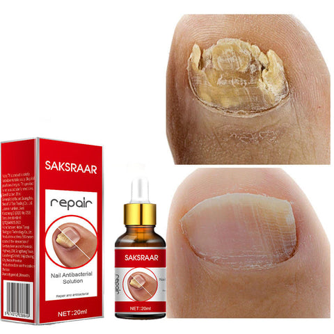SAKSRAAR NAIL TREATMENT SERUM Repair Serum 20ml