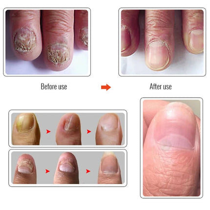 SAKSRAAR NAIL TREATMENT SERUM Repair Serum 20ml