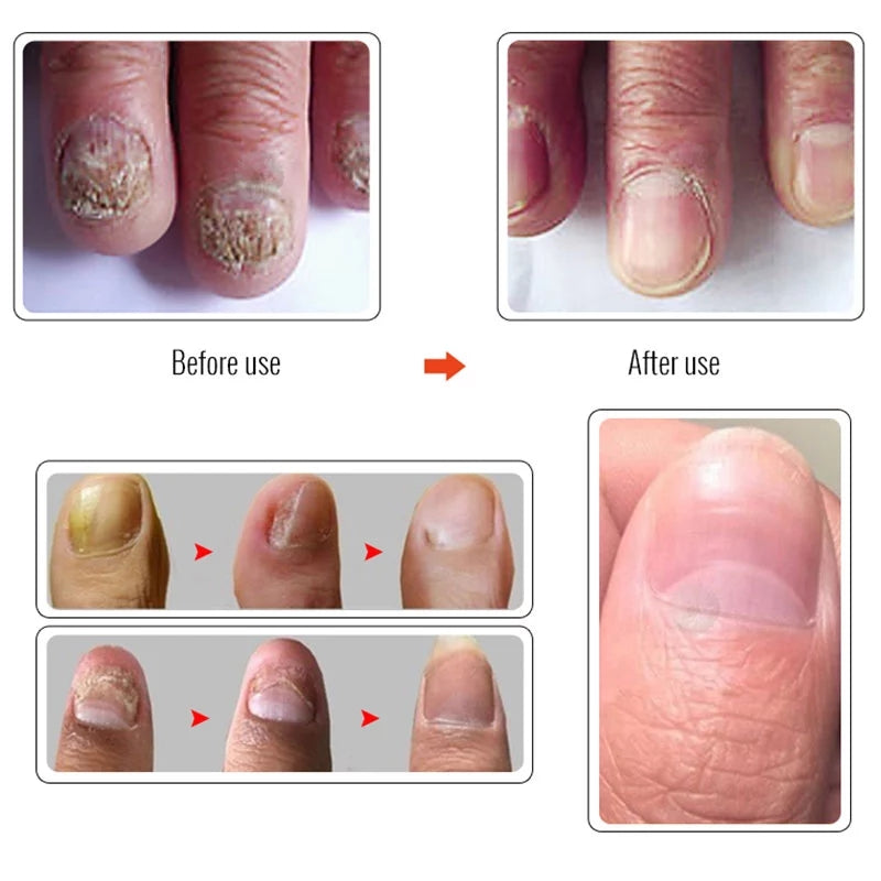 SAKSRAAR NAIL TREATMENT SERUM Repair Serum 20ml
