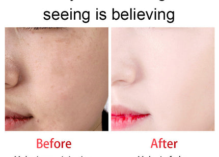 Arbutin Brightening Ampoule Niacinamide Facial Serum
